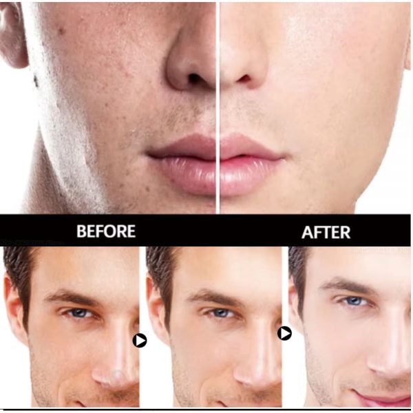Skin Care Kit - Image 13